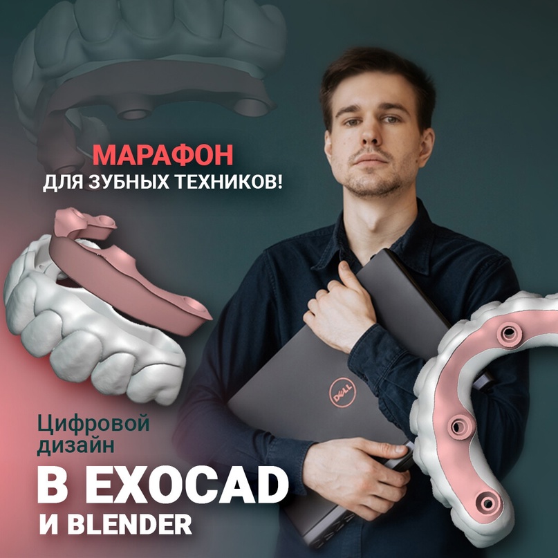 Как получить продаж на $2592 за 2 недели. Кейс Tesla Target и онлайн-курса для зубных техников, изображение №2